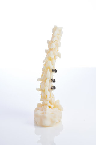 Stratasys Enhances Digital Anatomy 3D Printer to Bring Ultra-Realistic Simulation and Realism to Functional Bone Models